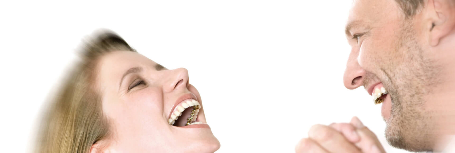 Lingual Braces