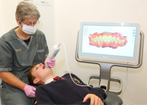 Scanning for Invisalign