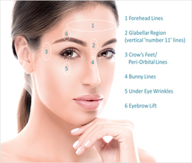 Anti-wrinkle injectionsprovide treatment